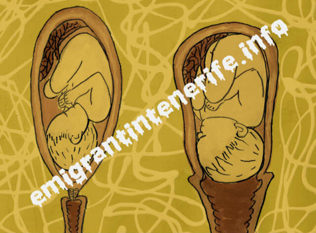 Ilustrație din cartea mea cu modificările ce au loc cu uterul și vaginul în timpul travaliului